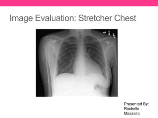 Image Evaluation: Stretcher Chest
Presented By:
Rochelle
Mazzella
 
