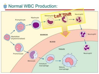 Pathology of WBC Disorders | PPTX