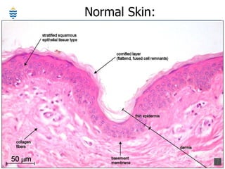 Pathology of Skin - Introduction | PPT
