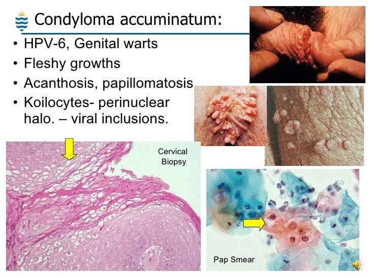 etiology vs pathology