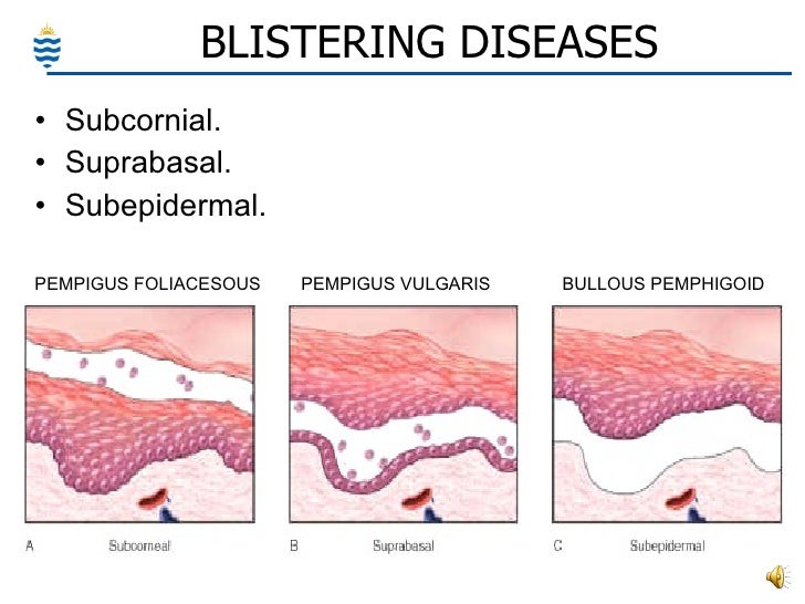 Pathology of Skin - Common Disorders Pathology of Skin - Common Disorders