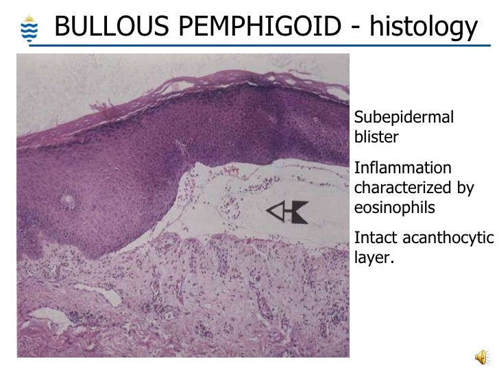Pathology of Skin - Common Disorders