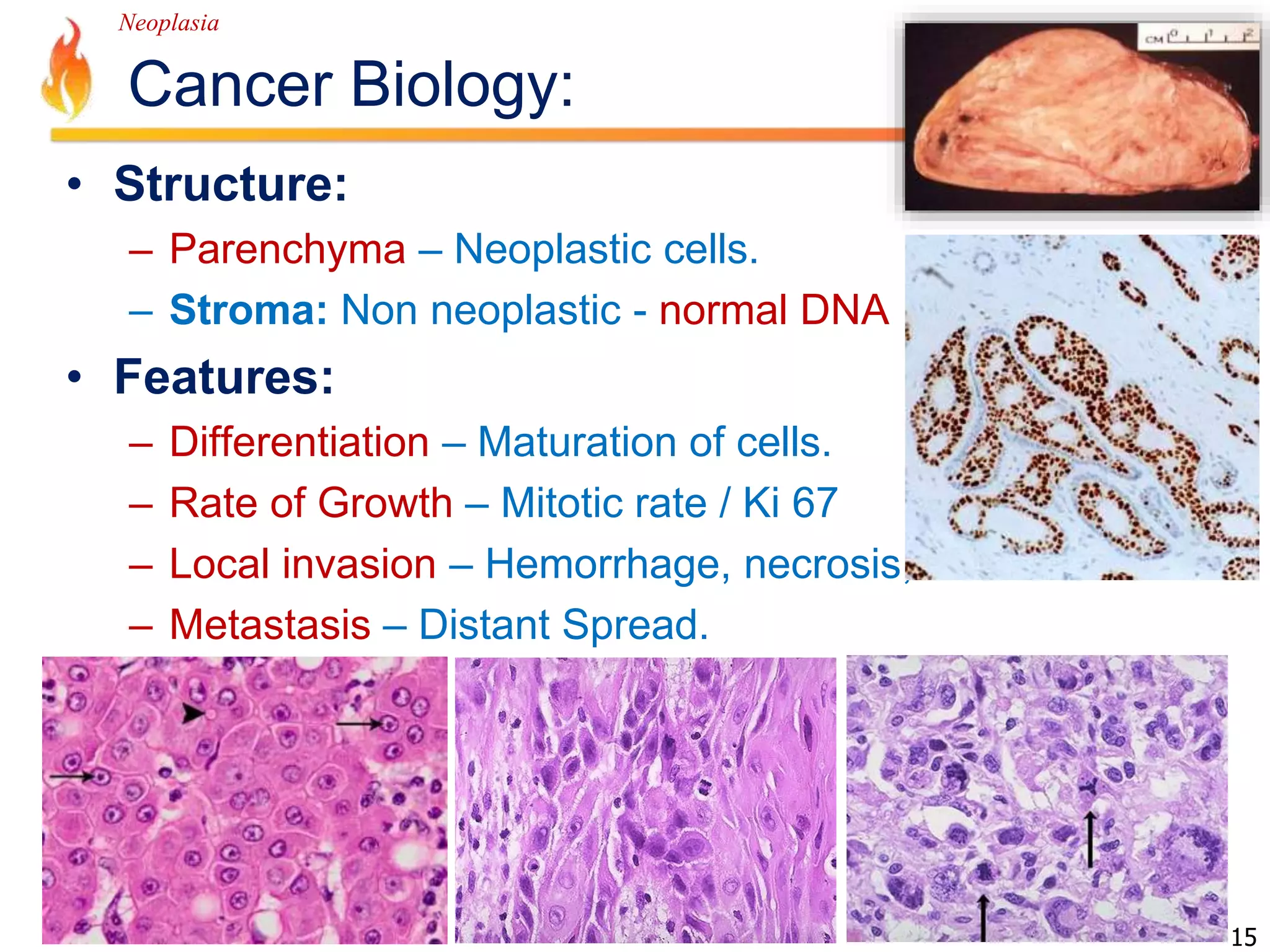 Neoplasia 
Cancer Biology: 
• Structure: 
– Parenchyma – Neoplastic cells. 
– Stroma: Non neoplastic - normal DNA 
• Features: 
– Differentiation – Maturation of cells. 
– Rate of Growth – Mitotic rate / Ki 67 
– Local invasion – Hemorrhage, necrosis, destruction 
– Metastasis – Distant Spread. 
15 
 