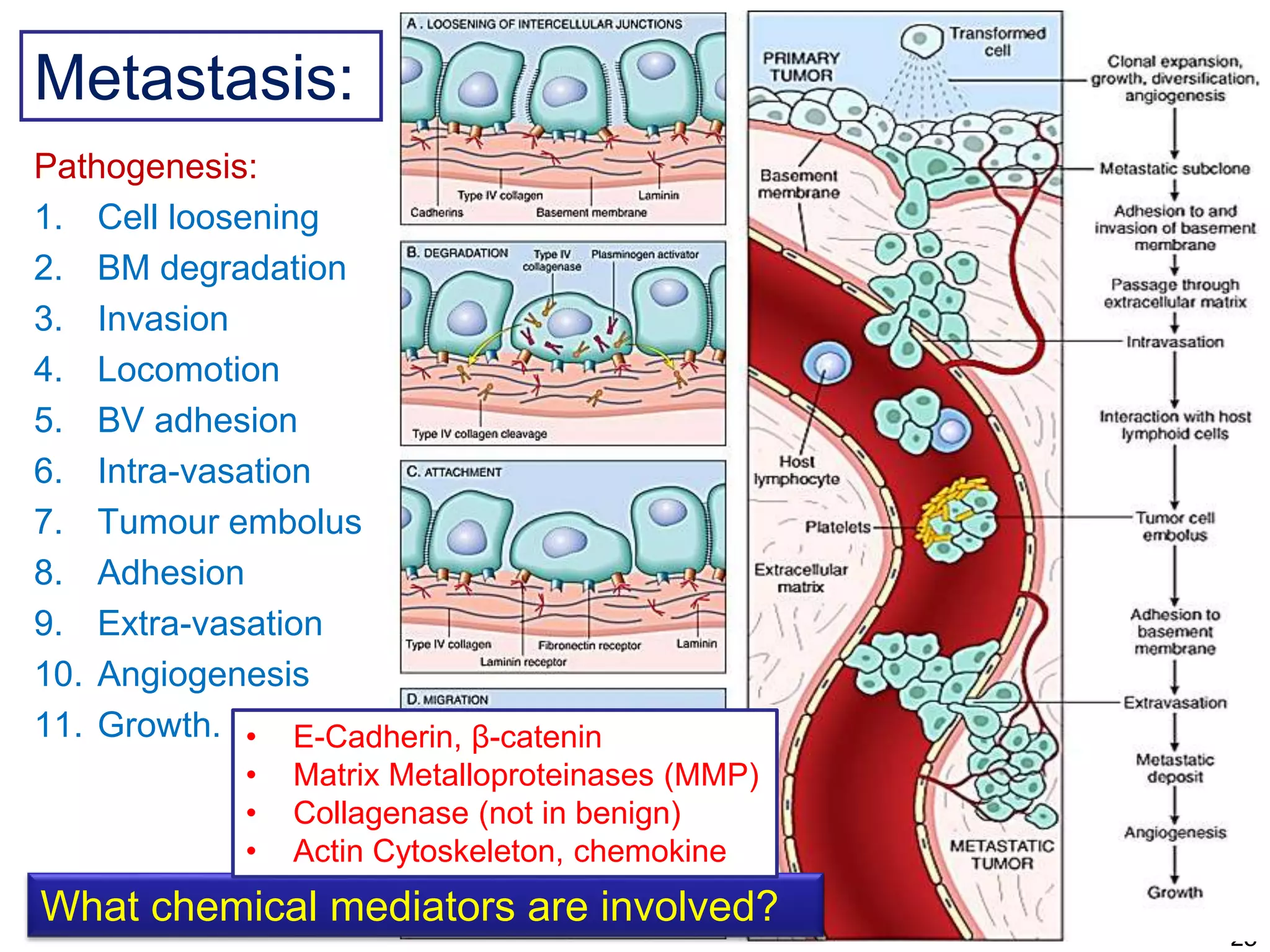 Metastasis: 
Pathogenesis: 
1. Cell loosening 
2. BM degradation 
3. Invasion 
4. Locomotion 
5. BV adhesion 
6. Intra-vasation 
7. Tumour embolus 
8. Adhesion 
9. Extra-vasation 
10. Angiogenesis 
11. Growth. 
28 
• E-Cadherin, β-catenin 
• Matrix Metalloproteinases (MMP) 
• Collagenase (not in benign) 
• Actin Cytoskeleton, chemokine 
What chemical mediators are involved? 
 