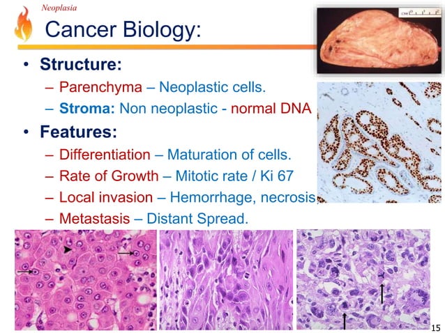 Pathology Lecture - Neoplasia | PPTX | Cancer | Diseases and Conditions