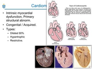 Cardiomyopathy:
• Intrinsic myocardial
dysfunction, Primary
structural abnorm.
• Congenital / Acquired.
• Types:
– Dilated 90%
– Hypertrophic
– Restrictive.

10

 