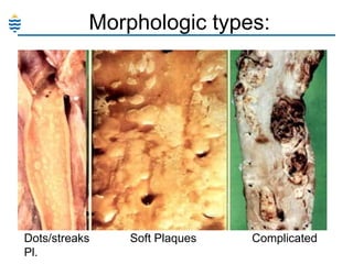 Morphologic types:

Dots/streaks
Pl.

Soft Plaques

Complicated

 