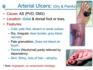 Arterial Ulcers: (Dry & Painful)
• Cause: AS (PVD, DM2)
• Location: distal & dorsal foot or toes.
• Features:
– Cold, pale feet, absent or weak pulses.
– Dry, Irregular clear border, grey black
necrotic.
– Pale granulation, Does not bleed on
touch.
– Painful (Nocturnal) partly relieved by
dependency.
– Skin: Shiny, loss of hair – atrophy.
* Note: Angiogram, no compression bandage..

 