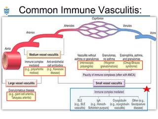 Common Immune Vasculitis:

 