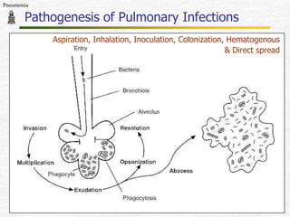 Pneumonia

Pathogenesis of Pulmonary Infections
Aspiration, Inhalation, Inoculation, Colonization, Hematogenous
& Direct spread

47

 