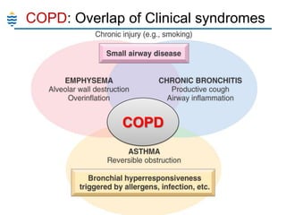 COPD: Overlap of Clinical syndromes

COPD

 