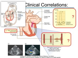 RHD: Clinical Correlations:
?

?

?

 