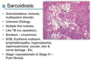 Sarcoidosis:
• Granulomatous, immune,
multisystem disorder.
• Unknown Etiology.
• Multiple fine nodules.
• Like TB (no caseation).
• Smokers – Uncommon
• SOB, Erythema nodosum,
lymphadenopathy, hypercalcemia,
nephrocalcinosis, occular, skin &
nerve damage.. Etc.
• Stage I asymptomatic to Stage IV –
Pulm fibrosis.

 