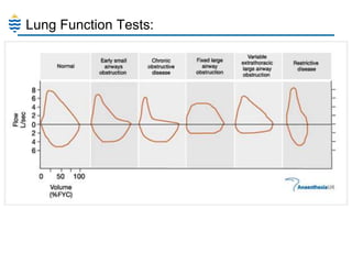 Lung Function Tests:

 