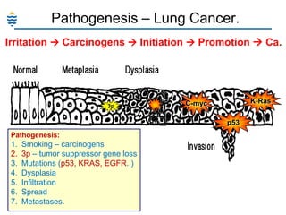 Pathogenesis – Lung Cancer.
Irritation  Carcinogens  Initiation  Promotion  Ca.

3p

K-Ras

C-myc
p53

Pathogenesis:

1.
2.
3.
4.
5.
6.
7.

Smoking – carcinogens
3p – tumor suppressor gene loss
Mutations (p53, KRAS, EGFR..)
Dysplasia
Infiltration
Spread
Metastases.

 