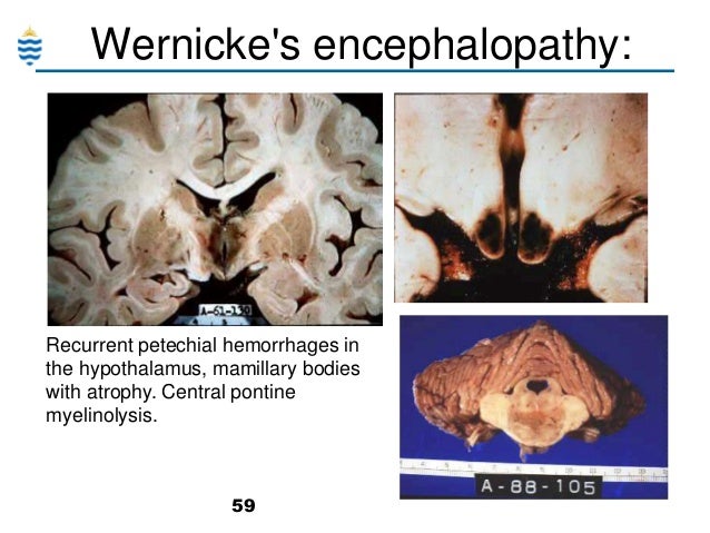 pathology definition psychology pathology definition psychology