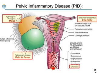 Pelvic Inflammatory Disease (PID):
Infertility

Mass

Pain & Fever

10

 