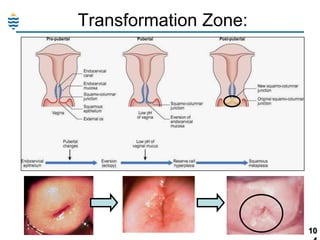Transformation Zone:

10

 