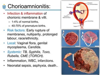 Chorioamnionitis:
• Infection & inflammation of
chorionic membrane & villi.
– 1-4% of normal births,
– 40-70% of premature births.

• Risk factors: Early rupture of
membranes, nulliparity, prolonged
labour, race/ethnicity.
• Local: Vaginal flora, genital
mycoplasma, Candida.
• Systemic: TB, Syphilis, Toxo,
Rubella, CME (TORCH).
• Inflammation, WBC, infarctions.
• Neonatal sepsis, asphyxia, death..
12

 