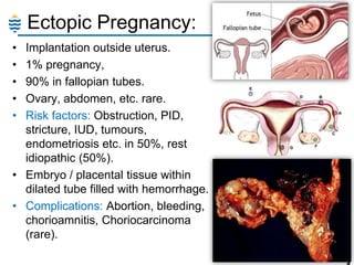 Ectopic Pregnancy:
•
•
•
•
•

Implantation outside uterus.
1% pregnancy,
90% in fallopian tubes.
Ovary, abdomen, etc. rare.
Risk factors: Obstruction, PID,
stricture, IUD, tumours,
endometriosis etc. in 50%, rest
idiopathic (50%).
• Embryo / placental tissue within
dilated tube filled with hemorrhage.
• Complications: Abortion, bleeding,
chorioamnitis, Choriocarcinoma
(rare).
13

 
