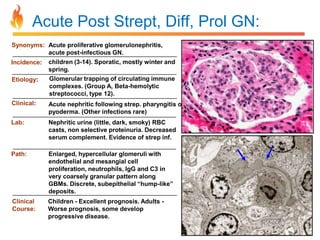 Acute Post Strept, Diff, Prol GN:
Synonyms: Acute proliferative glomerulonephritis,
acute post-infectious GN.
Incidence:
Etiology:

children (3-14). Sporatic, mostly winter and
spring.
Glomerular trapping of circulating immune
complexes. (Group A, Beta-hemolytic
streptococci, type 12).

Clinical:

Acute nephritic following strep. pharyngitis or
pyoderma. (Other infections rare)

Lab:

Nephritic urine (little, dark, smoky) RBC
casts, non selective proteinuria. Decreased
serum complement. Evidence of strep inf.

Path:

Enlarged, hypercellular glomeruli with
endothelial and mesangial cell
proliferation, neutrophils, IgG and C3 in
very coarsely granular pattern along
GBMs. Discrete, subepithelial “hump-like”
deposits.

Clinical
Course:

Children - Excellent prognosis. Adults Worse prognosis, some develop
progressive disease.

 
