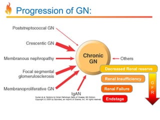 Progression of GN:

Decreased Renal reserve

Renal Insufficiency
Renal Failure
Endstage

G
F
R

 