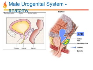 Male Urogenital System anatomy

BPH

 