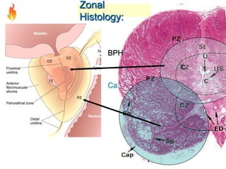 Zonal
Histology:

BPH

Ca.

 