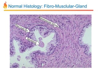 Normal Histology: Fibro-Musclular-Gland

 
