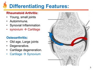 Differentiating Features:
Rheumatoid Arthritis:
• Young, small joints
• Autoimmune.
• Synovial Inflammation
• synovium  Cartilage
Osteoarthritis:
• Old age, Large joints
• Degenerative.
• Cartilage degeneration.
• Cartilage  Synovium

5

 