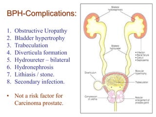 BPH-Complications:
1.
2.
3.
4.
5.
6.
7.
8.

Obstructive Uropathy
Bladder hypertrophy
Trabeculation
Diverticula formation
Hydroureter – bilateral
Hydronephrosis
Lithiasis / stone.
Secondary infection.

• Not a risk factor for
Carcinoma prostate.

 