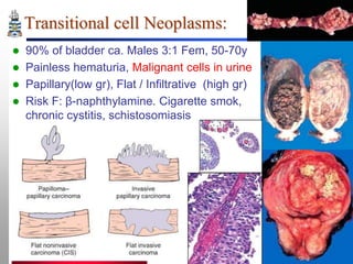 Transitional cell Neoplasms:





90% of bladder ca. Males 3:1 Fem, 50-70y
Painless hematuria, Malignant cells in urine
Papillary(low gr), Flat / Infiltrative (high gr)
Risk F: β-naphthylamine. Cigarette smok,
chronic cystitis, schistosomiasis

 