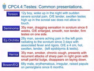 CPC4.4:Testes: Common presentations.
Torsion 12y boy, woke up in the night with sudden
severe scrotal pain. O/E tender, swollen testes
high up in the scrotal sac does not allow to
touch.

Seminoma 35y man, dragging sensation in scrotum since 6
weeks. O/E enlarged, smooth, non tender, firm
testes on one side.
 28y man, severe aching pain in the left groin
Ep.Orchitis radiating to the scrotum since 3 days with
associated fever and rigors. O/E a 4 cm, hot,
swollen, tender, (left epididymis & testis).
 35y man, smoker, chronic cough, presents with
Hernia
recurrent attacks of sharp pain in right groin with
small painful bulge, disappears on laying down.
Bowen/EQ 68y male, erythematous, irregular, raised papule
on penis/glans since 6 months.

 