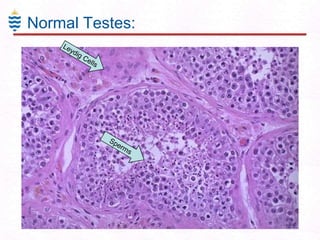 Normal Testes:

 