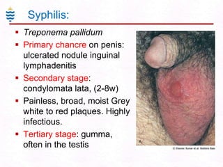 Syphilis:
 Treponema pallidum
 Primary chancre on penis:
ulcerated nodule inguinal
lymphadenitis
 Secondary stage:
condylomata lata, (2-8w)
 Painless, broad, moist Grey
white to red plaques. Highly
infectious.
 Tertiary stage: gumma,
often in the testis

 