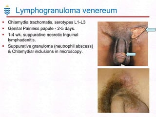 Lymphogranuloma venereum
 Chlamydia trachomatis, serotypes L1-L3
 Genital Painless papule - 2-5 days.
 1-4 wk. suppurative necrotic Inguinal
lymphadenitis.
 Suppurative granuloma (neutrophil abscess)
& Chlamydial inclusions in microscopy.

 