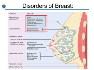 Disorders of Breast:

 