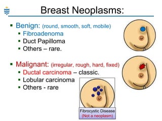 Breast Neoplasms:
 Benign: (round, smooth, soft, mobile)
 Fibroadenoma
 Duct Papilloma
 Others – rare.

 Malignant: (irregular, rough, hard, fixed)
 Ductal carcinoma – classic.
 Lobular carcinoma
 Others - rare

Fibrocystic Disease
(Not a neoplasm)

 