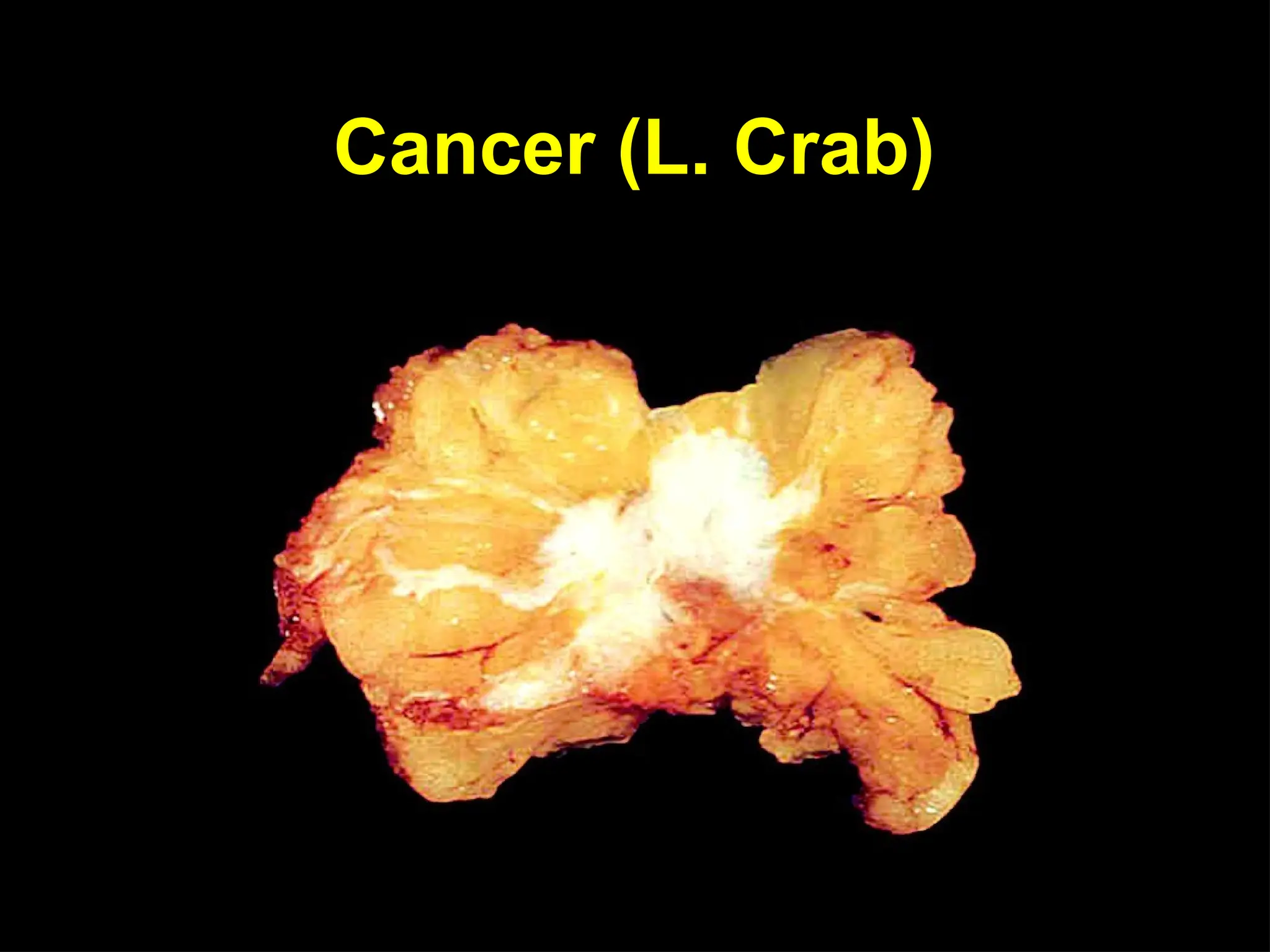 Cancer (L. Crab)
 