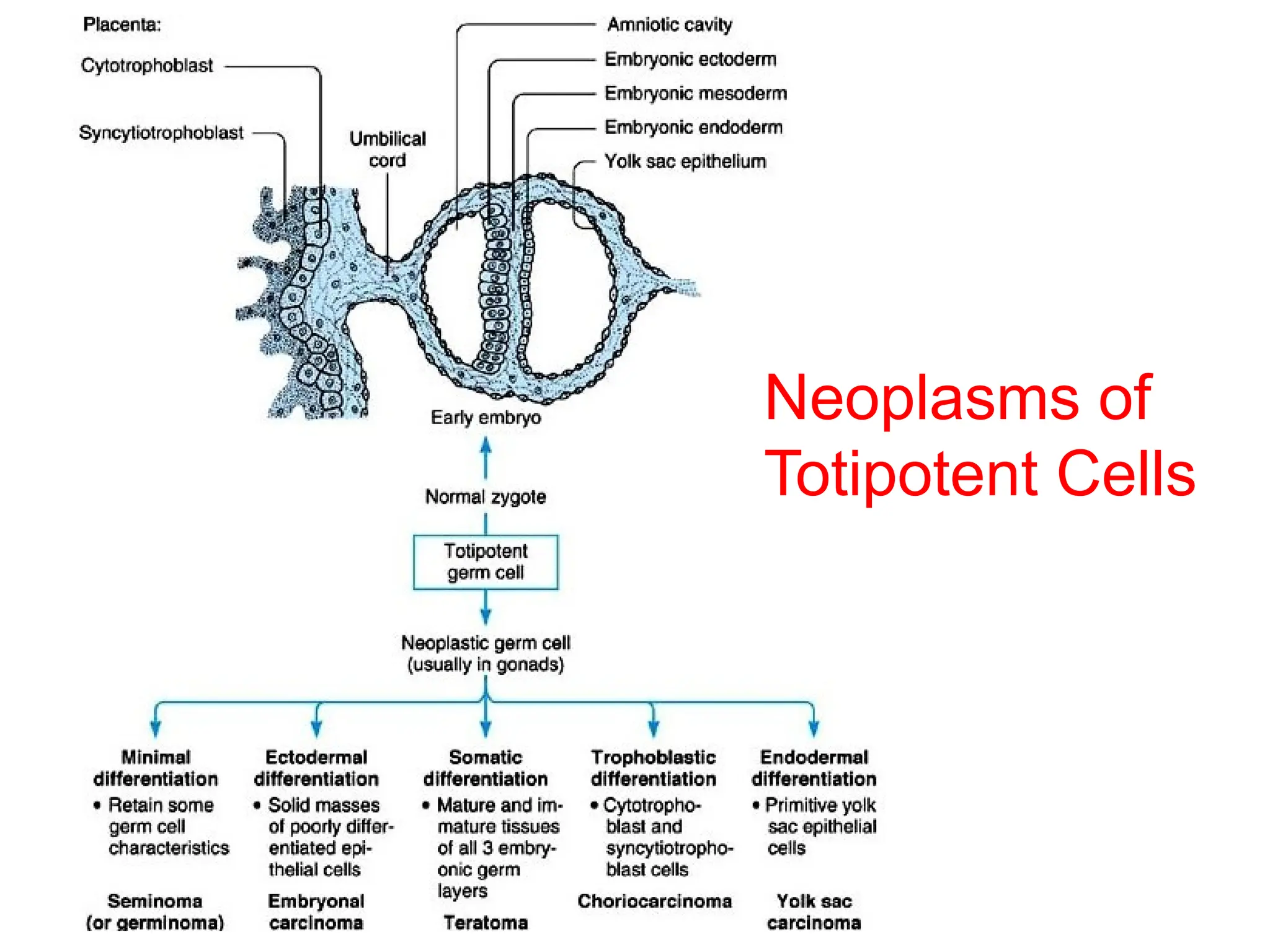 Neoplasms of
Totipotent Cells
 