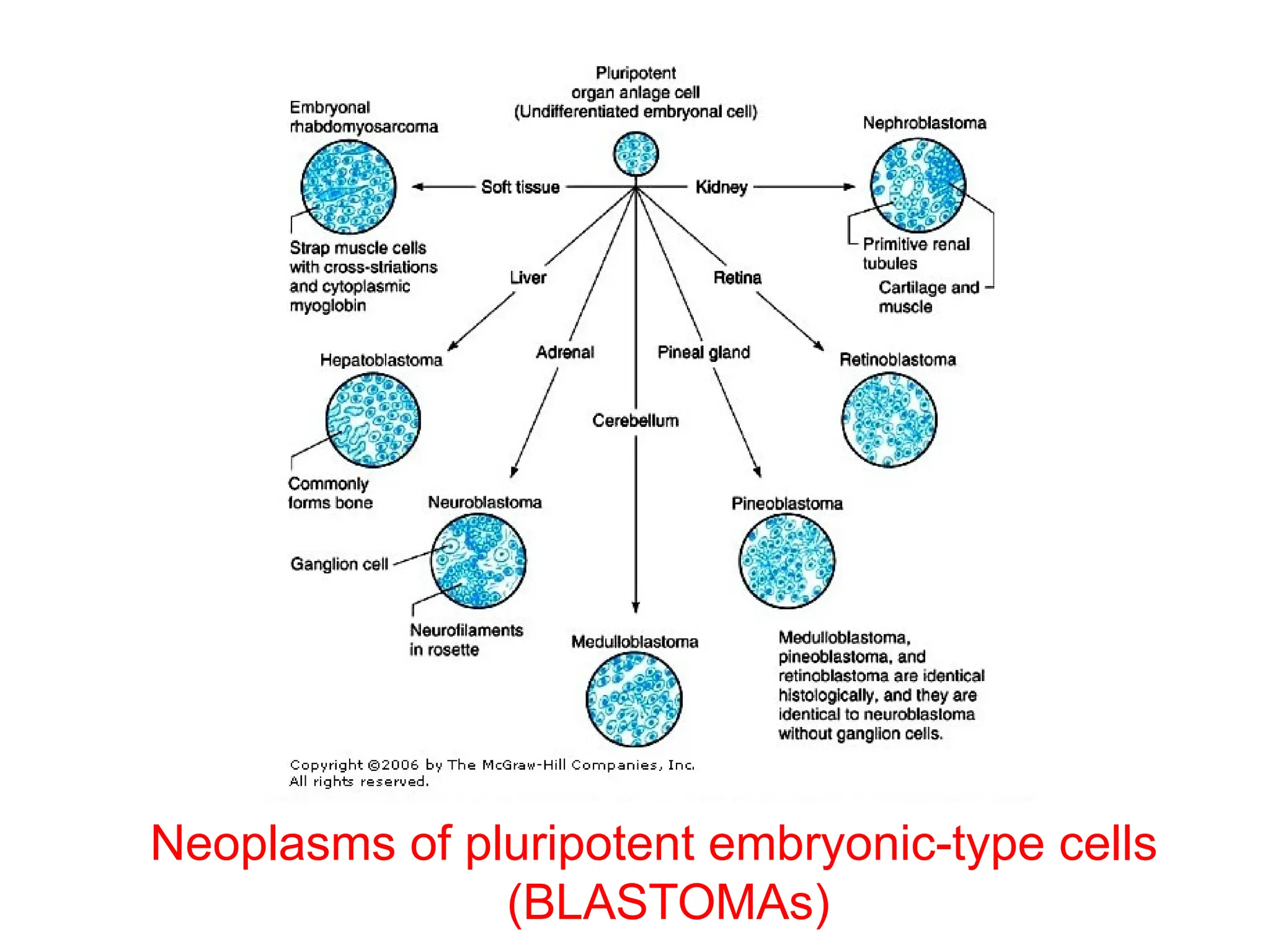 Neoplasms of pluripotent embryonic-type cells
(BLASTOMAs)
 