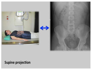 Normal Rug X Ray Medicine approach to plain abdominal XRAYS.pptx