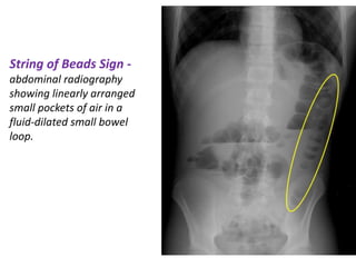 Medicine approach to plain abdominal XRAYS.pptx