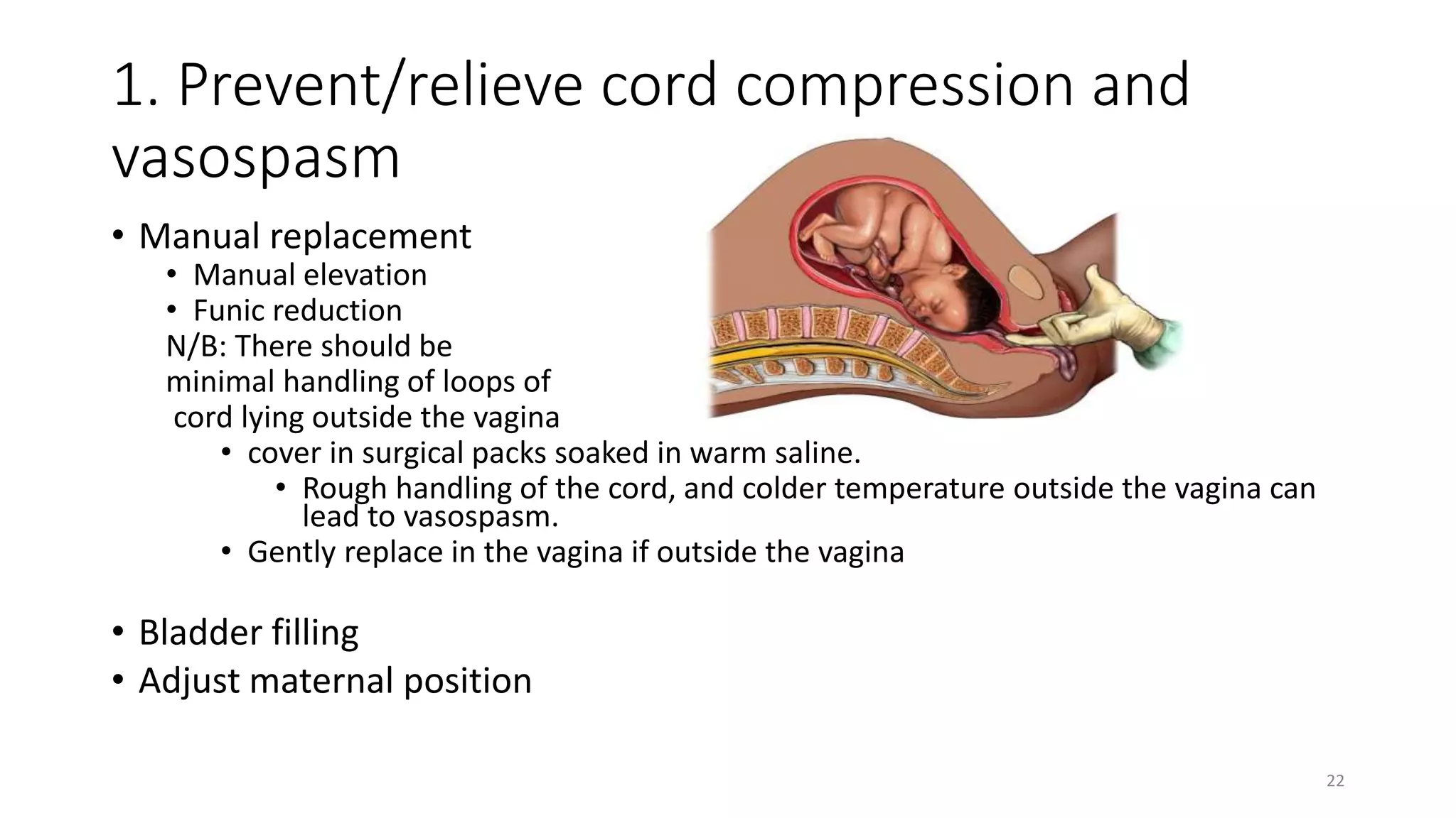 1. Prevent/relieve cord compression and
vasospasm
• Manual replacement
• Manual elevation
• Funic reduction
N/B: There should be
minimal handling of loops of
cord lying outside the vagina
• cover in surgical packs soaked in warm saline.
• Rough handling of the cord, and colder temperature outside the vagina can
lead to vasospasm.
• Gently replace in the vagina if outside the vagina
• Bladder filling
• Adjust maternal position
22
 