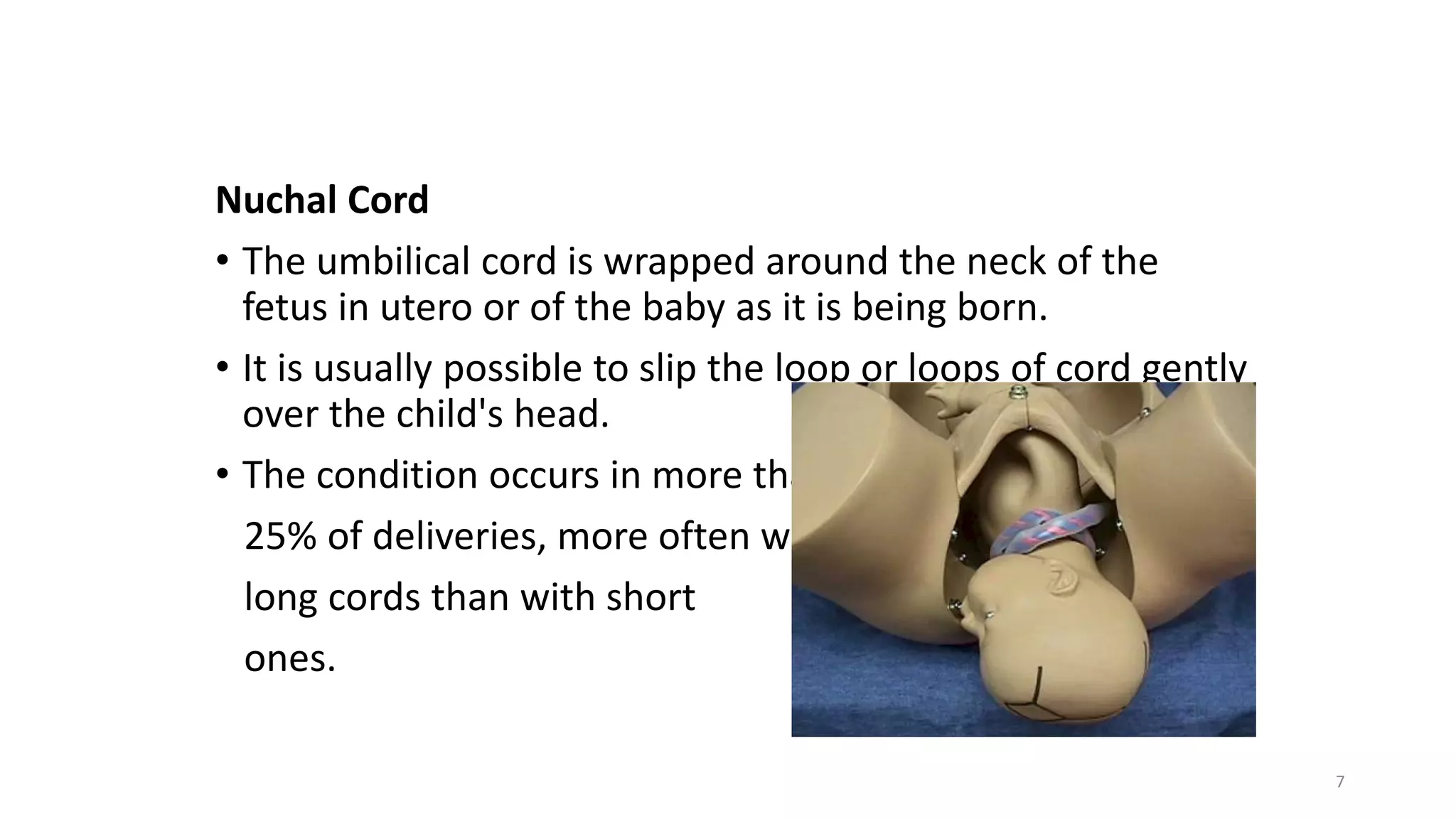 Nuchal Cord
• The umbilical cord is wrapped around the neck of the
fetus in utero or of the baby as it is being born.
• It is usually possible to slip the loop or loops of cord gently
over the child's head.
• The condition occurs in more than
25% of deliveries, more often with
long cords than with short
ones.
7
KATTEY K.A (MBBS, MPH)
 
