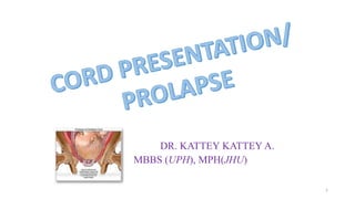 DR. KATTEY KATTEY A.
MBBS (UPH), MPH(JHU)
1
 