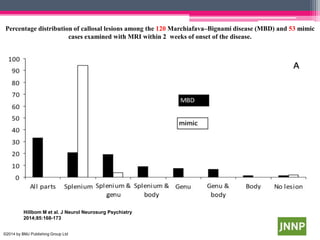 Percentage distribution of callosal lesions among the 120 Marchiafava–Bignami disease (MBD) and 53 mimic
cases examined with MRI within 2 weeks of onset of the disease.

Hillbom M et al. J Neurol Neurosurg Psychiatry
2014;85:168-173
©2014 by BMJ Publishing Group Ltd

 