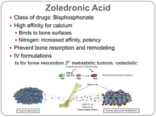 Metastatic Bone Disease & Role of Zoledronic Acid | PPTX
