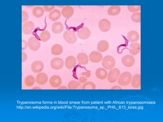 Trypanosoma forms in blood smear from patient with African trypanosomiasis
http://en.wikipedia.org/wiki/File:Trypanosoma_sp._PHIL_613_lores.jpg
 