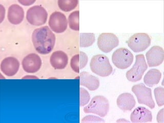 Plasmodium in red blood cell
 